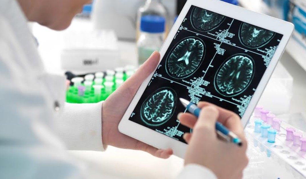 El diagnóstico temprano puede marcar la diferencia en enfermedades raras