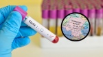 Foto: Cortesía OMS exige respuesta urgente tras avance del Ébola en República del Congo