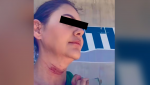 Foto: Cortesía Mujer denuncia en video las marcas de una cirugía estética